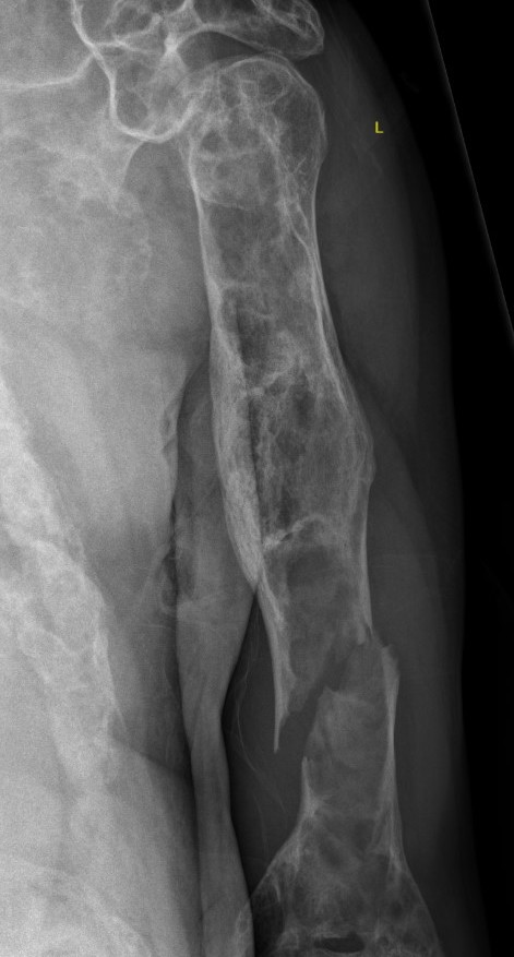 FD Humerus 1