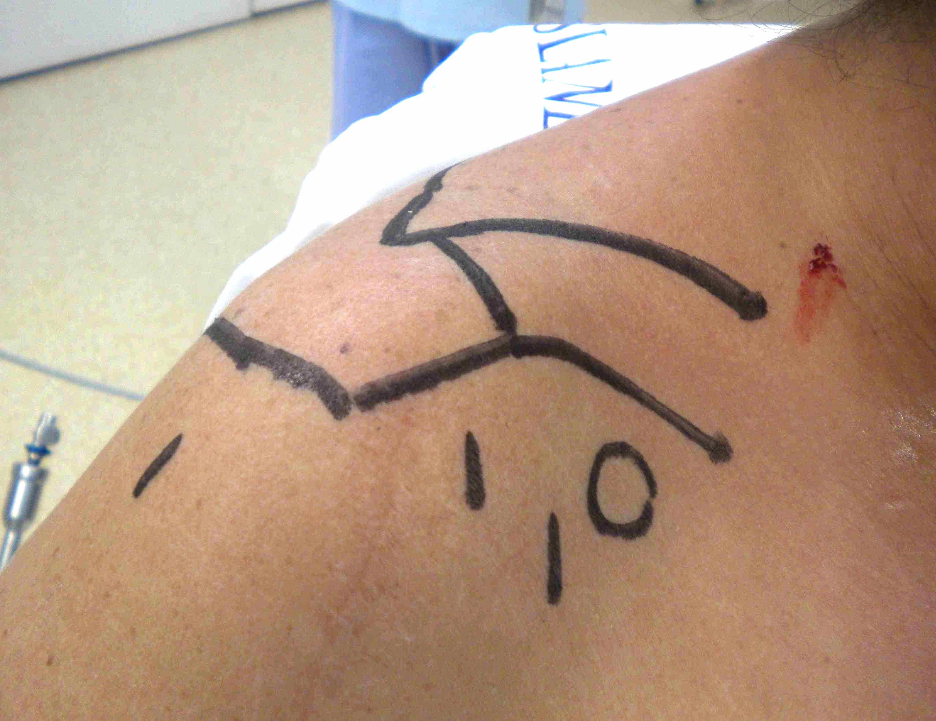 anterior