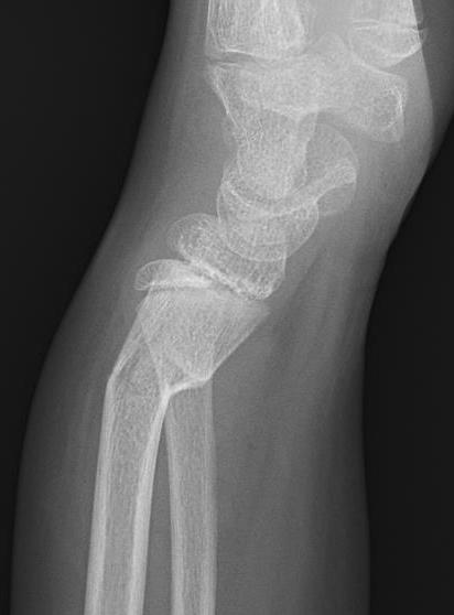DR