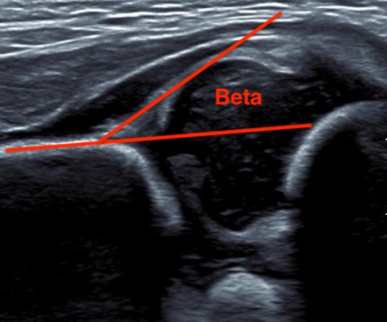 beta