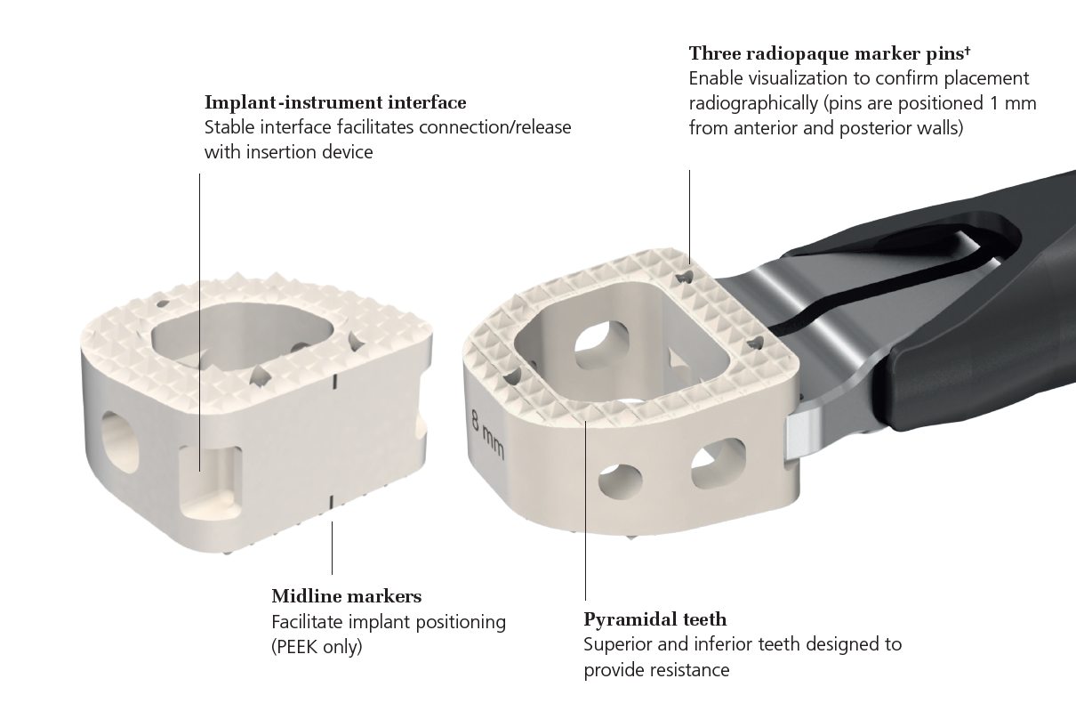 Interbody spacer