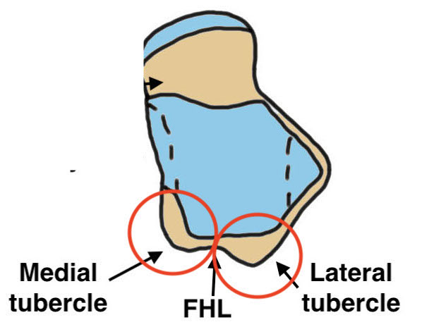 Posterior process