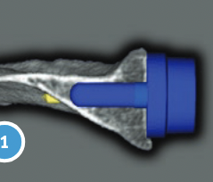 nav ct
