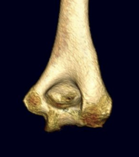humerus