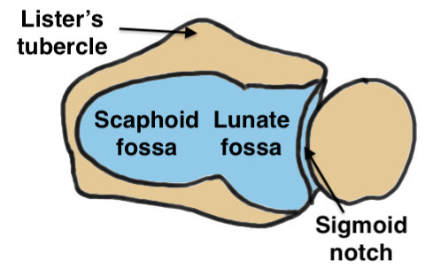 Sigmoid notch