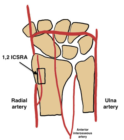 12 CSRA